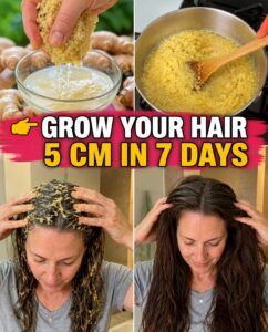 Grow Your Hair With Ginger: What You Can Really Expect