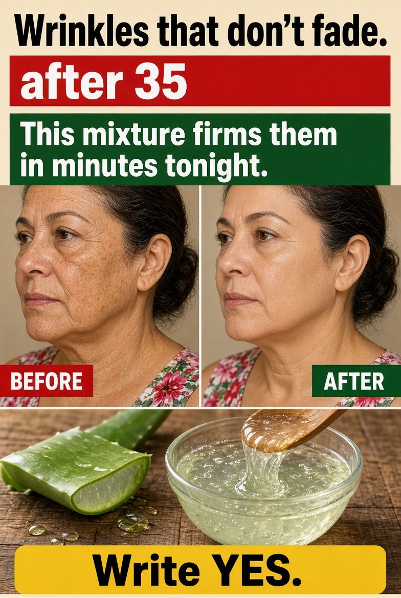 Wrinkles After 35