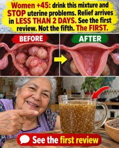 The Mixture That Claims to Shrink Bloating Fibroids in Two Days for Women Over 45
