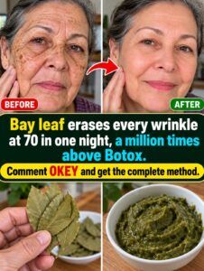Bay Leaf Erases Wrinkles at 70 Overnight? The Claim Examined