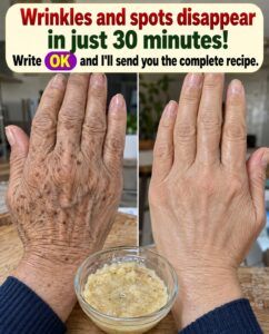 Wrinkles and Spots Disappear in 30 Minutes? The Homemade Hand Trick Explained
