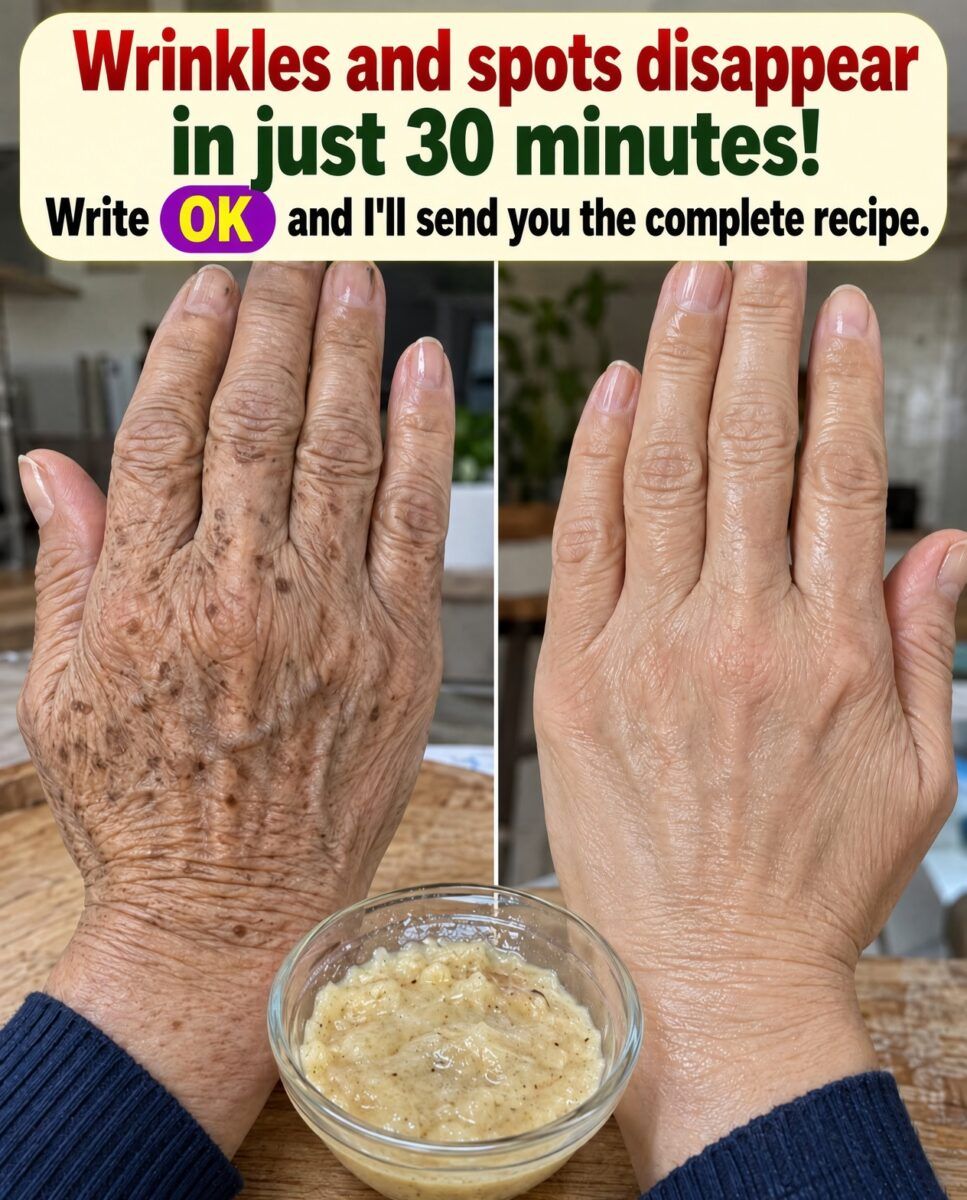 Wrinkles and Spots Disappear in 30 Minutes? The Homemade Hand Trick Explained