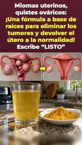 ¿Presión pélvica después de los 45? Una bebida de cúrcuma y jengibre activa un reinicio en la parte baja del cuerpo