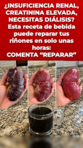 Este remedio desencadena un lavado renal que lo cambia todo en la orina