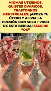 Presión de miomas y quistes: lo que desencadena esta infusión verde