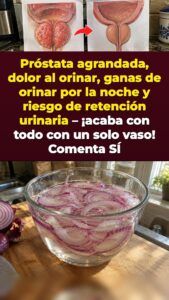 Cebolla morada remojada para la presión de la próstata y las idas al baño de madrugada