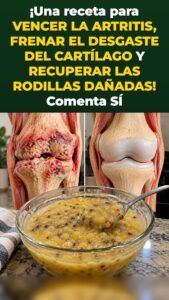 Un tazón de avena reinicia tus articulaciones: tus rodillas lo notan rápido