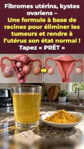 Pression pelvienne après 45 ans ? Une boisson curcuma-gingembre déclenche une remise à zéro du bas du corps
