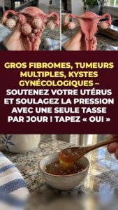 Fibromes utérins et kystes ovariens : ce que le gingembre et le curcuma déclenchent dans votre bassin