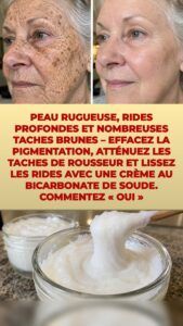 Appliquez une crème au bicarbonate ce soir – ce qu’elle fait aux rides et aux taches brunes