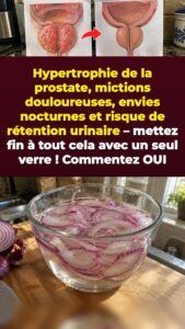 Oignon rouge trempé contre la pression prostatique et les réveils de 2 h du matin