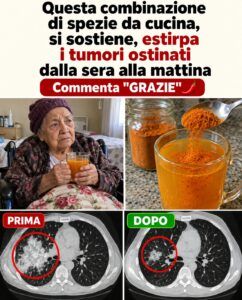 Assicurati di non trascurare questa semplice miscela di spezie da cucina ogni mattina