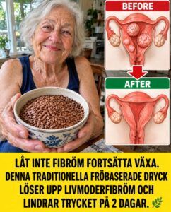Vad linfrön utlöser inuti myom vill kosttillskottsindustrin inte säga