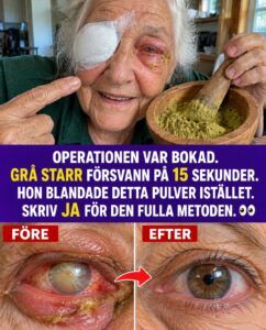 Pulvret som vände en dömd ögonhistoria upp och ner
