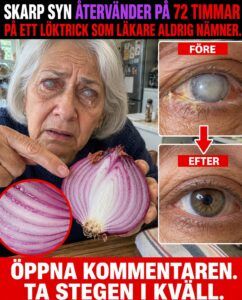 Synen återhämtar sig snabbt med lök: tricket läkarna hoppar över