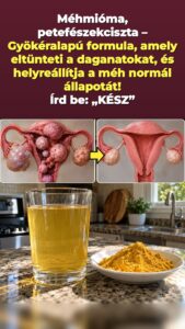 Medencei nyomás 45 után? A kurkumás-gyömbéres ital újraindítja az alhasat