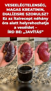 Ez a házi szer olyan veseöblítést indít be, amely mindent megváltoztat a vizeletben