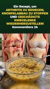 Eine Schüssel Haferflocken löst einen Gelenk-Reset aus – deine Knie spüren es schnell