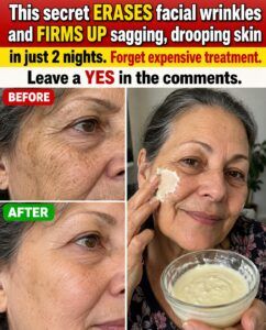 This Secret With Homemade Cream Said to Erase Wrinkles and Firm the Face in 2 Nights