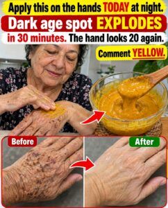 Apply This Yellow Cream on the Hands and Erase Dark Age Spots