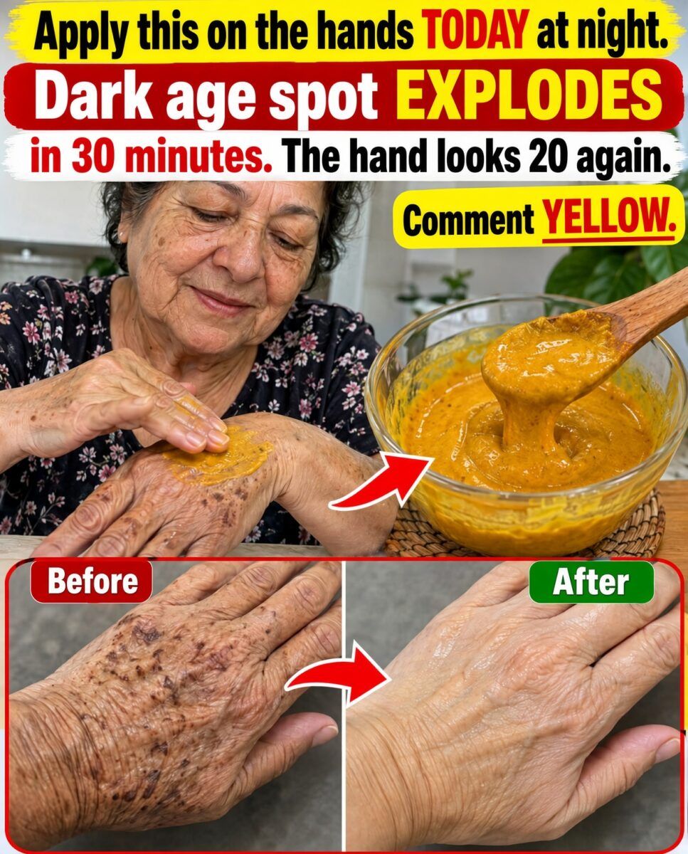 Apply This Yellow Cream on the Hands and Erase Dark Age Spots