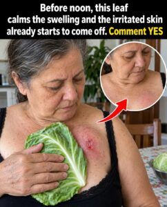 This Leaf Calms Swelling and Makes Irritated Skin Start to Let Go