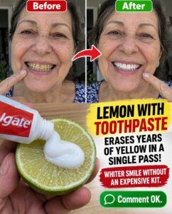 Lemon With Toothpaste: The Trick That Promises to Erase the Yellow From Your Smile