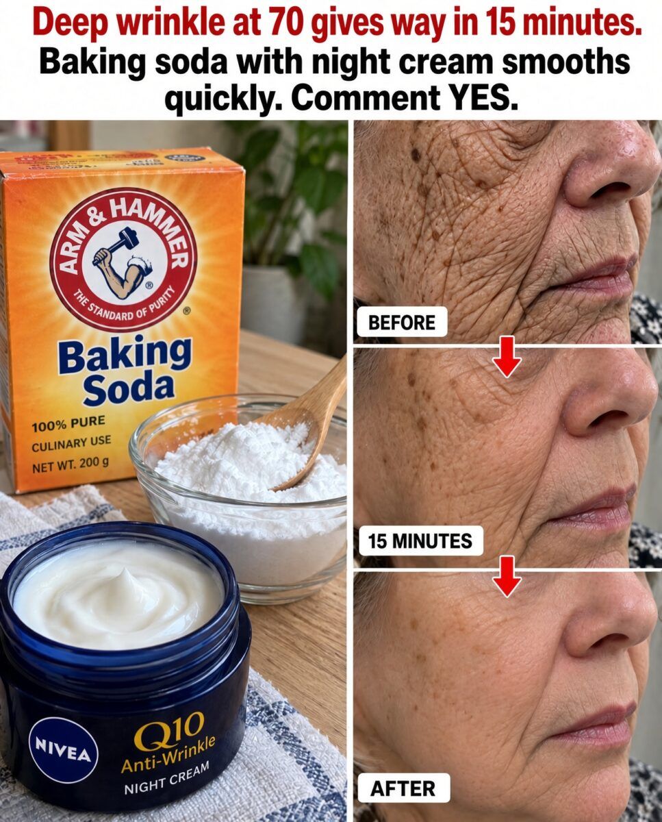 Deep Wrinkles Collapse When Baking Soda Enters the Night Cream