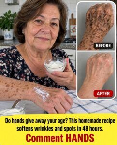 The Hands Reveal Your Age — This Homemade Recipe Softens Wrinkles and Spots Fast