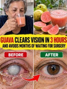 Guava Cleans Cloudy Vision and Shakes Up Cataracts in an Unexpected Way