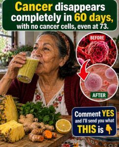 This Juice Erases Cancer in 60 Days — Pineapple, Lemon, Ginger and Turmeric