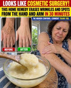 Stop Hiding Your Hands and Arms: The Homemade Remedy Said to Erase Wrinkles and Spots in 30 Minutes