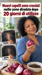Cipolla: 4 ricette naturali per capelli più forti, folti e lucenti