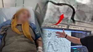 Karadeniz Ereğli’de şiddetli öksürük kalp damarını yırttı: Milyonda bir görülen vaka stentle kurtarıldı