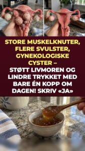Muskelknuter og eggstokkcyster: Hva ingefær og gurkemeie setter i gang i bekkenet ditt