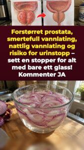 Bløtlagt rødløk mot prostatatrykk og nattlige dobesøk
