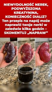 Ten domowy sposób uruchamia płukanie nerek, które zmienia wszystko w kwestii moczu