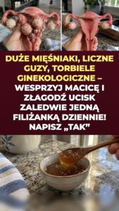 Mięśniaki macicy i torbiele jajników: co imbir i kurkuma uruchamiają w twojej miednicy