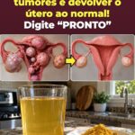 Pressão pélvica depois dos 45? Bebida de cúrcuma e gengibre desencadeia um reinício na parte inferior do corpo