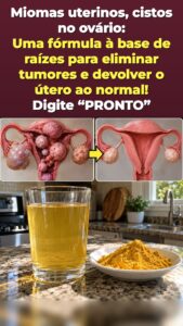 Pressão pélvica depois dos 45? Bebida de cúrcuma e gengibre desencadeia um reinício na parte inferior do corpo