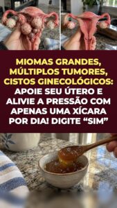 Miomas uterinos e cistos no ovário: o que o gengibre e a cúrcuma desencadeiam na sua pelve