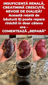 Acest remediu declanșează o spălare a rinichilor care schimbă totul în privința urinei