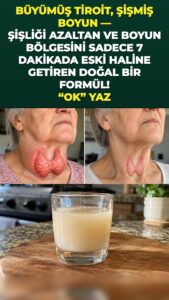 Şişmiş tiroidi çiğ soğanın gizli kesik hücre etkisiyle hızla rahatlatın