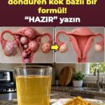 45 yaşından sonra pelvik baskı mı? Zerdeçal-zencefil içeceği alt bedende bir sıfırlamayı tetikliyor