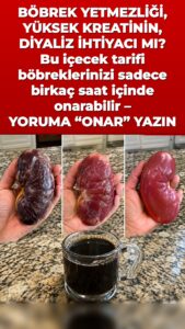 Bu çare idrarda her şeyi değiştiren bir böbrek arınmasını tetikliyor
