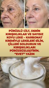 Bu akşam karbonat kremi sürün – kırışıklıklara ve koyu lekelere ne yapıyor